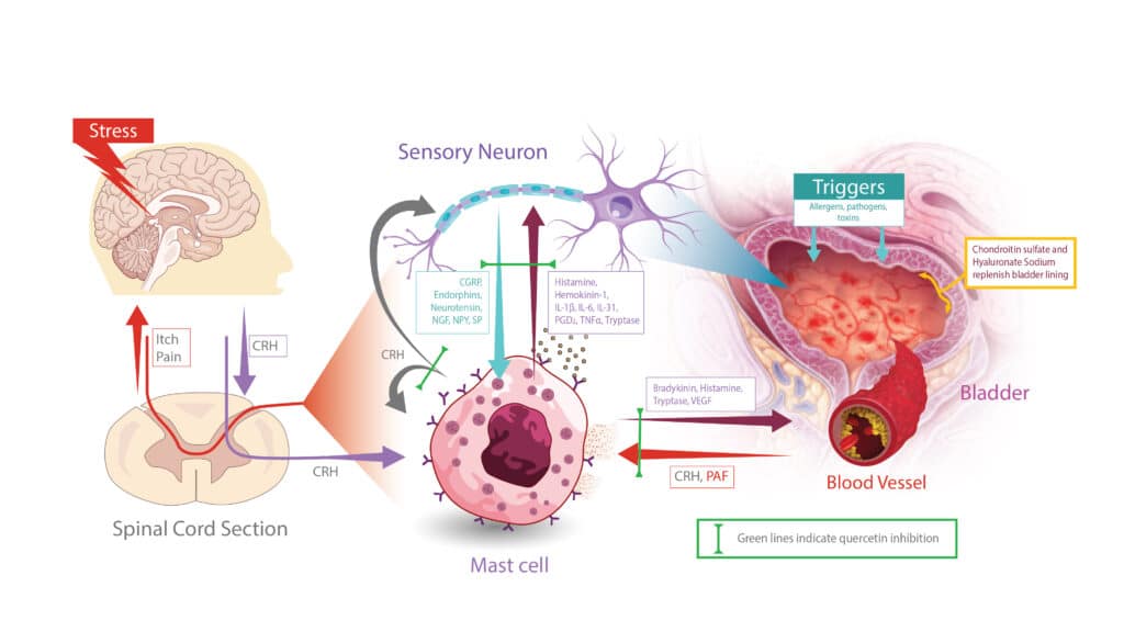 Mast-Cell-Triggers-and-actions-Bladder-New-01-1024x576